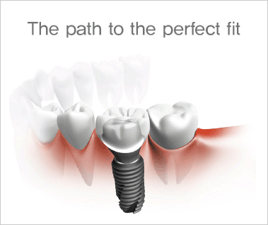 The path to the perfect fit
