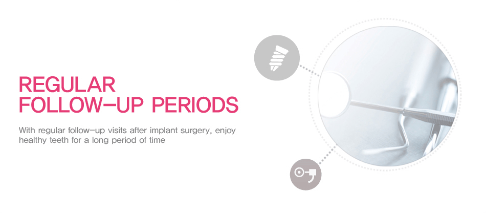 REGULAR FOLLOW-UP PERIODS : With regular follow-up visits after implant surgery, enjoy healthy teeth for a long period of time